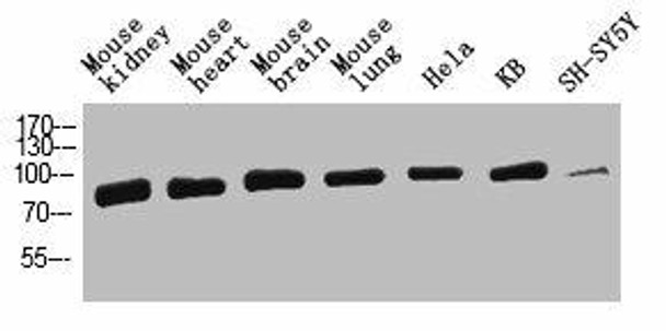 HSPA1A Antibody PACO07255