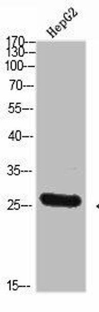 TPSD1 Antibody PACO07265