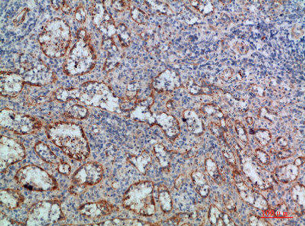 LTB Antibody PACO07384