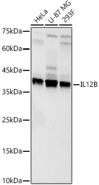 Western blot analysis of various lysates, using IL12B Rabbit pAb (CAB23054) at 1:800 dilution. Secondary antibody: HRP Goat Anti-Rabbit IgG (H+L) at 1:10000 dilution. Lysates/proteins: 25ug per lane. Blocking buffer: 3% nonfat dry milk in TBST.