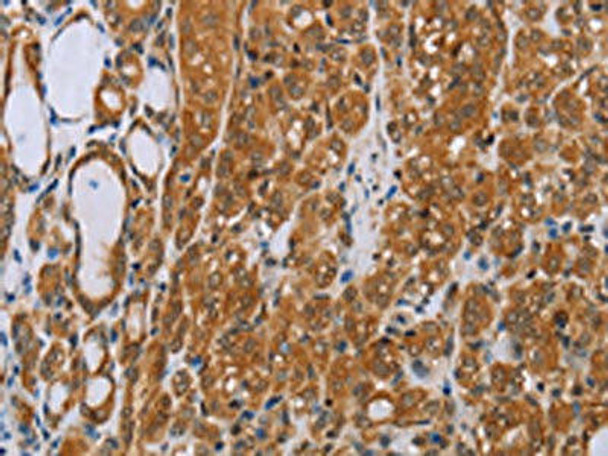 ADAMTS15 Antibody PACO14104