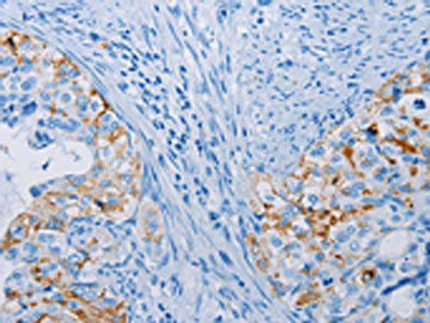 CA10 Antibody PACO14180