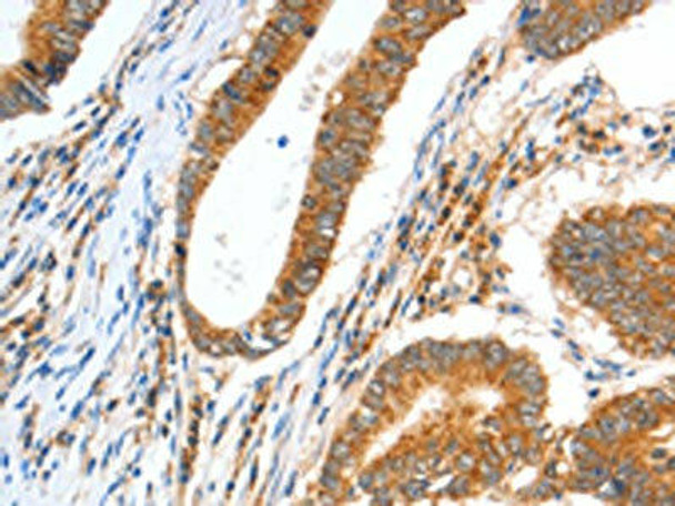 CCNF Antibody PACO14312