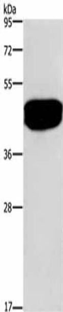 SDCCAG3 Antibody PACO14324