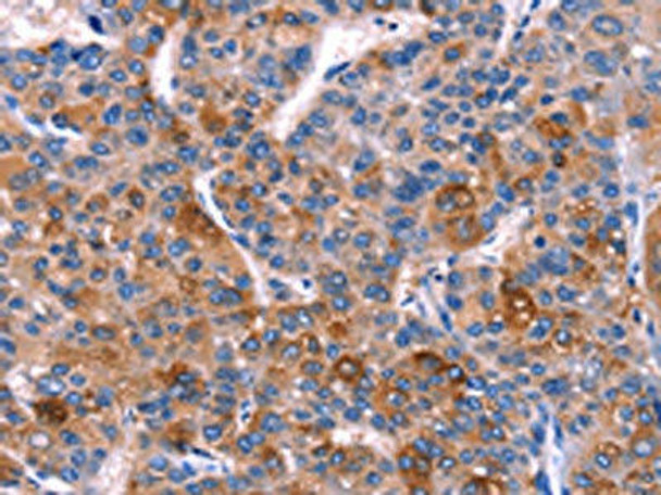 DUSP13 Antibody PACO14389