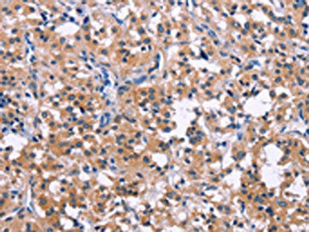 DUSP13 Antibody PACO14390