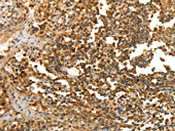 LRP12 Antibody PACO14654