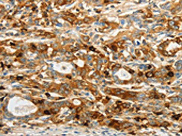 OASL Antibody PACO14793