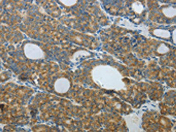 DNAJC3 Antibody PACO14816