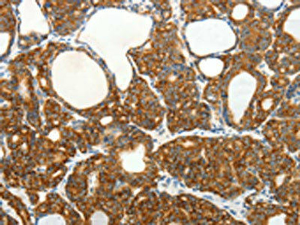 SLC12A4 Antibody PACO14996