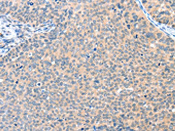 AADACL2 Antibody PACO15216