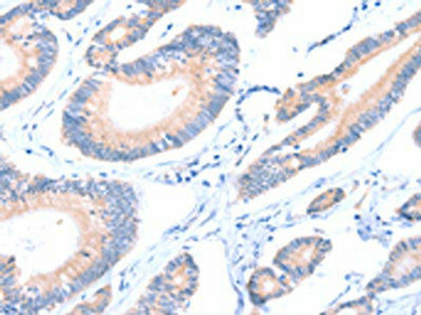 AADACL2 Antibody PACO15217