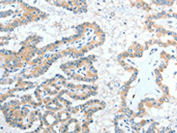 ADAM7 Antibody PACO15310