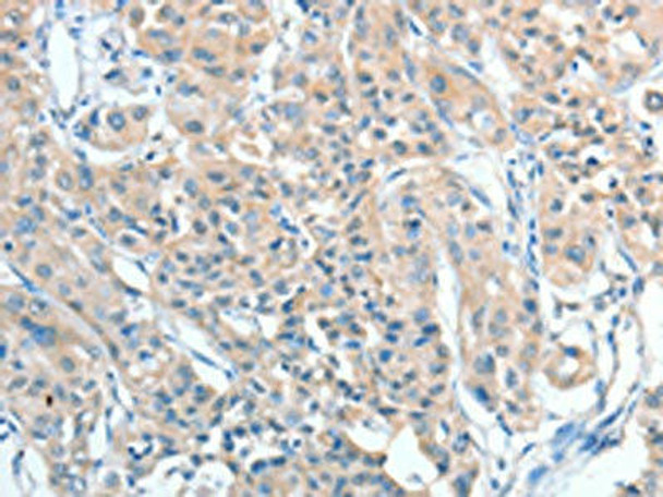 AGBL2 Antibody PACO15341