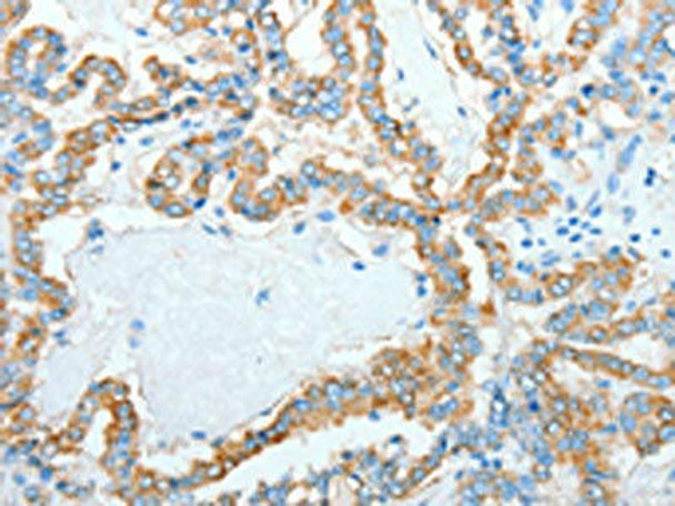 AGR3 Antibody PACO15352