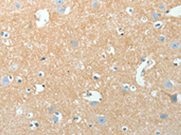 AKAP7 Antibody PACO15357