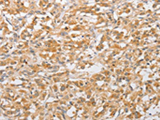 CSGALNACT2 Antibody PACO15719