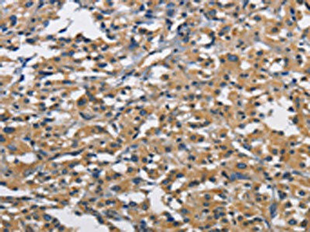 CBY1 Antibody PACO15727