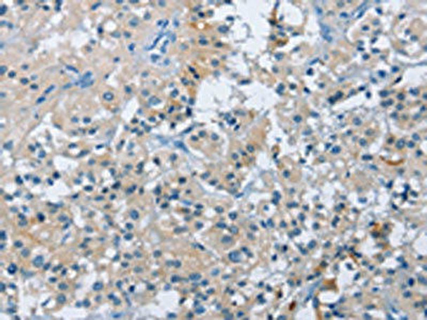 BTN2A2 Antibody PACO15892