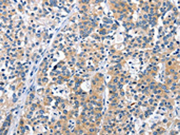 CEP97 Antibody PACO16017