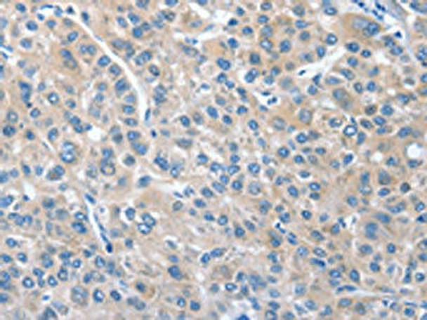 CGB Antibody PACO16021
