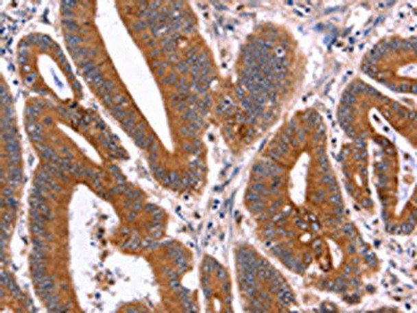 CRISP3 Antibody PACO16075