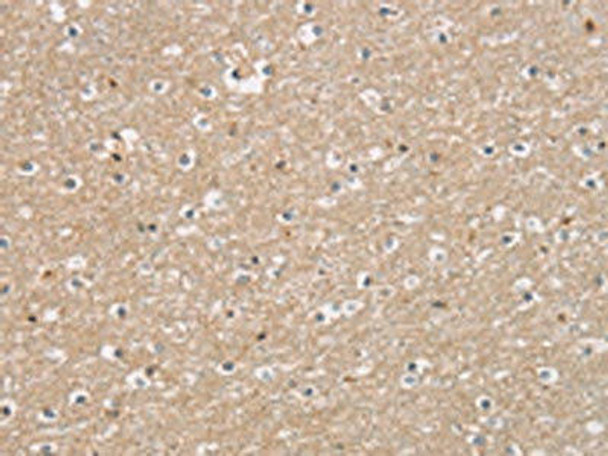 DMRT3 Antibody PACO16192