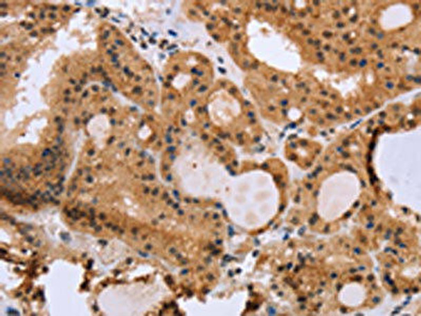 EPDR1 Antibody PACO16259