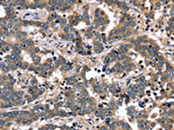 FGFR1OP2 Antibody PACO16343