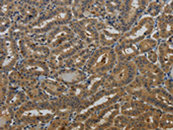 KCNK17 Antibody PACO16578