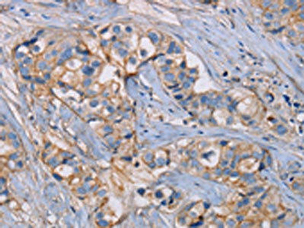 GHITM Antibody PACO16687