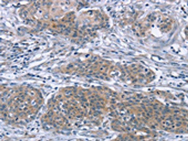 PDLIM2 Antibody PACO16850