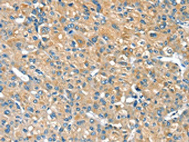 PILRB Antibody PACO16869