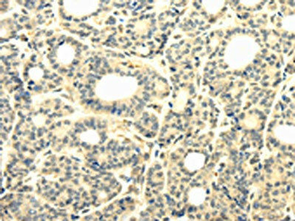 TBC1D22A Antibody PACO17210