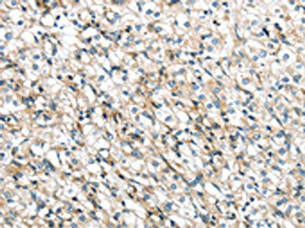 TMPRSS11B Antibody PACO17286