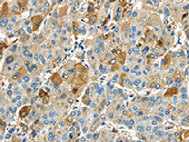 TNFAIP2 Antibody PACO17287