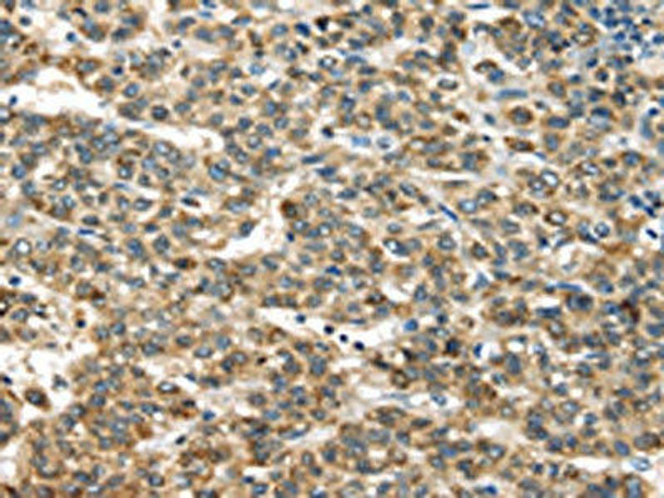 TNFAIP2 Antibody PACO17288