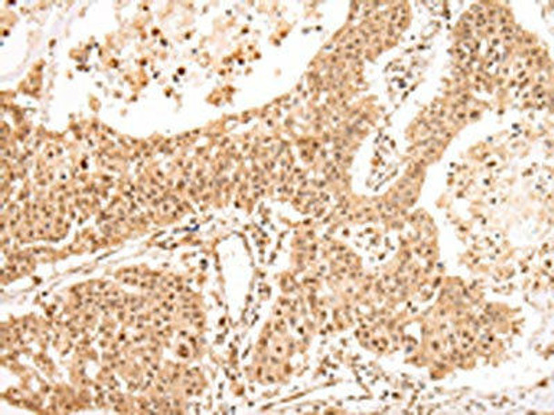 USP45 Antibody PACO17402