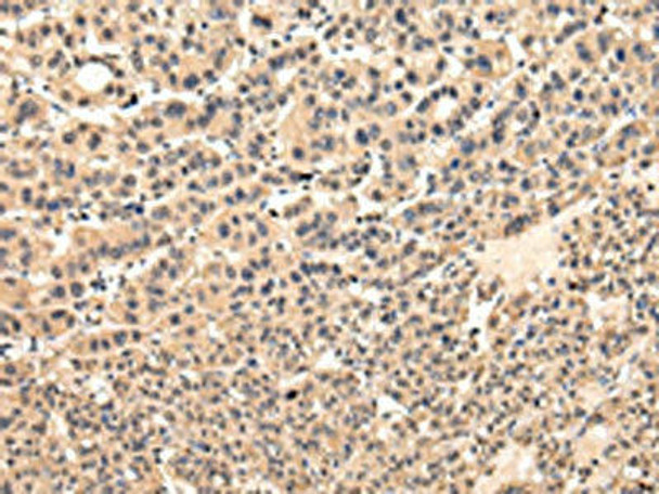 VPS37D Antibody PACO17446