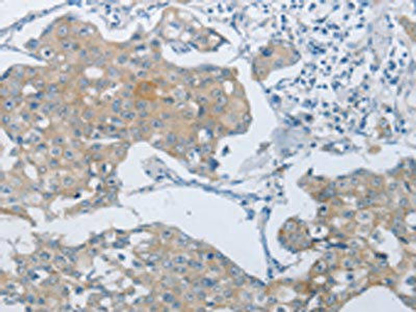 ABCB9 Antibody PACO17474