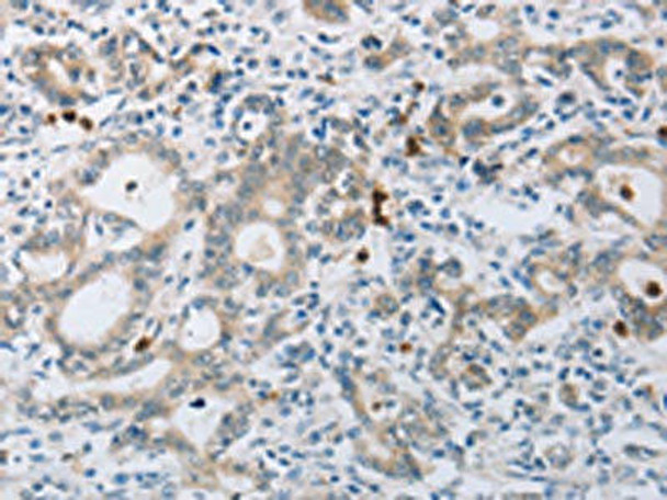 ABCB9 Antibody PACO17474