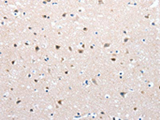 FOXD2 Antibody PACO17888