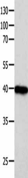 FOXL1 Antibody PACO17898