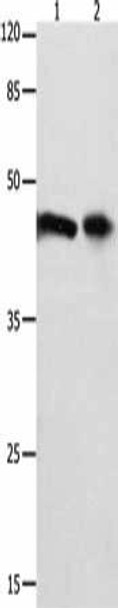 FOXL1 Antibody PACO17899