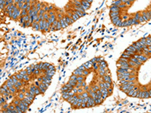 GDF6 Antibody PACO17980