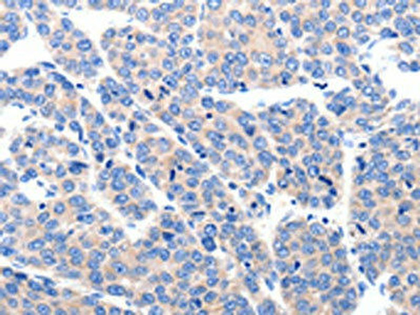 KCNH8 Antibody PACO18046