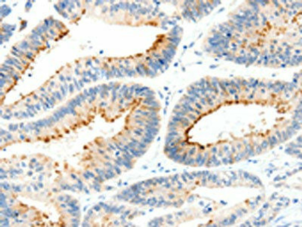 MAP4K1 Antibody PACO18444