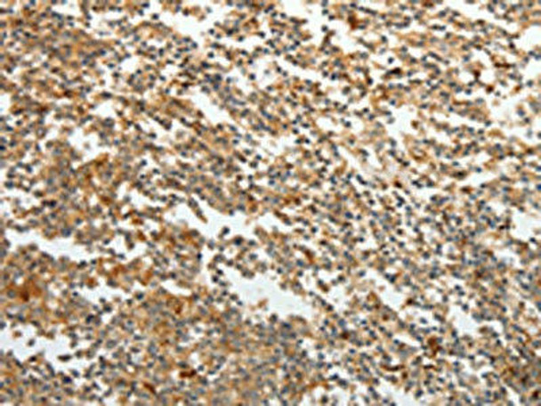 TMSB10 Antibody PACO18474