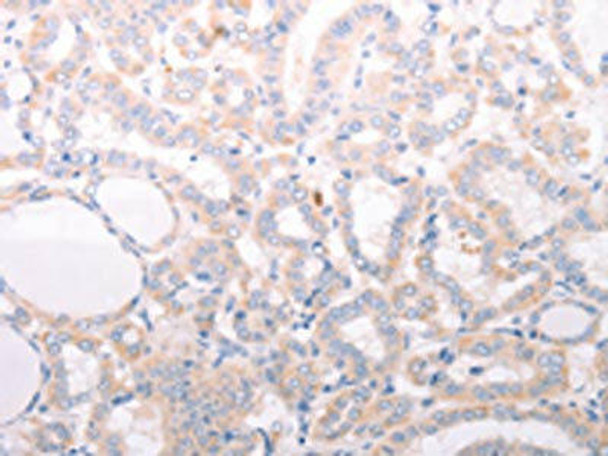 ANKRA2 Antibody PACO18562