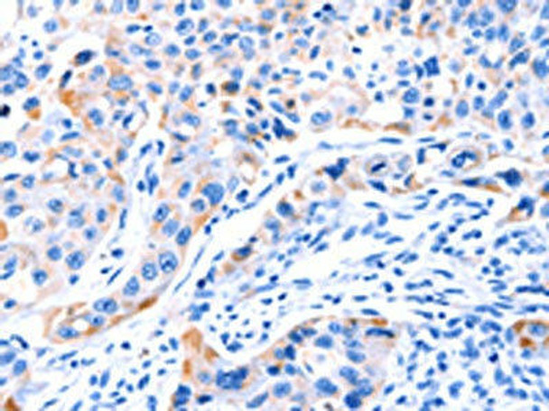 SMG8 Antibody PACO18645